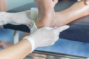 Causes and Treatment of Pressure Ulcers